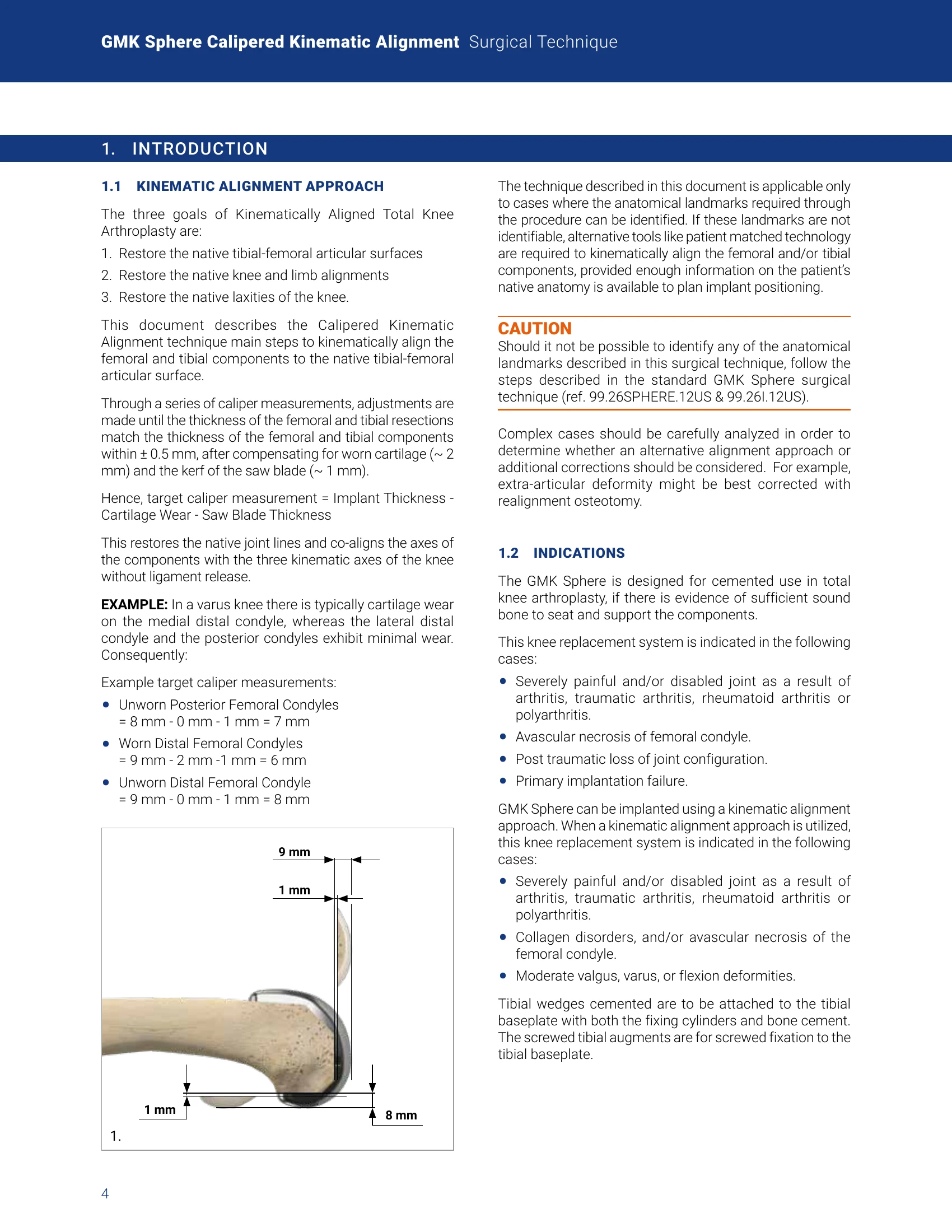 Manual for GMK Sphere Calipered Kinematic Alignment